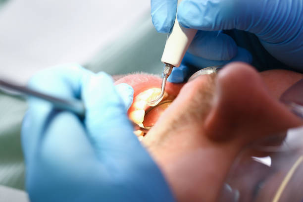 Best Emergency Dentist for Knocked-Out Tooth in Pine Ridge, SC