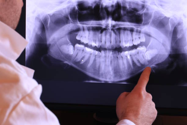 Best Broken or Cracked Tooth Emergency Dentist in Pine Ridge, SC
