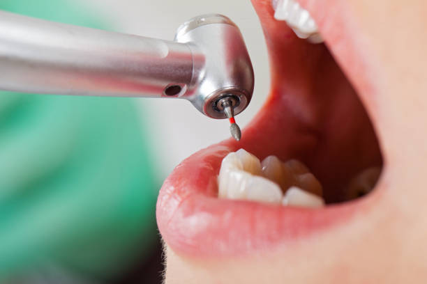 Best Emergency Dental Services for Seniors in Pine Ridge, SC